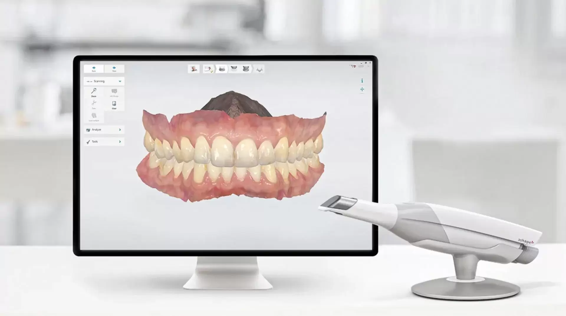 Digital Smile Design software showing before and after smile simulation on a calibrated 4K display